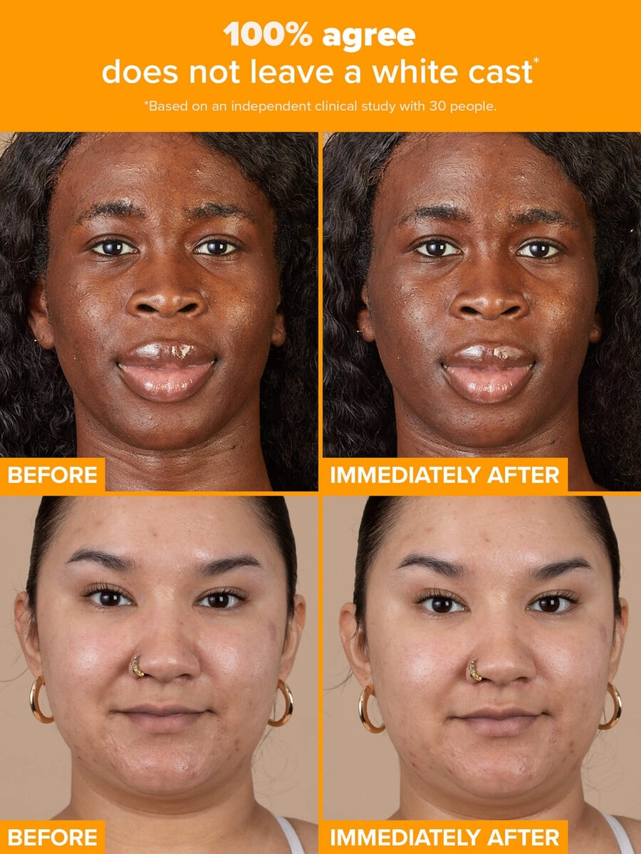 hydratační krém s 5 vitamínem c a spf 50