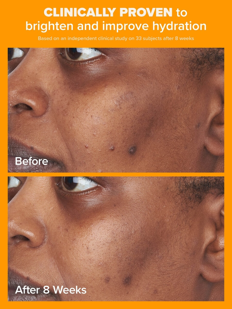 hydratační krém s 5 vitamínem c a spf 50