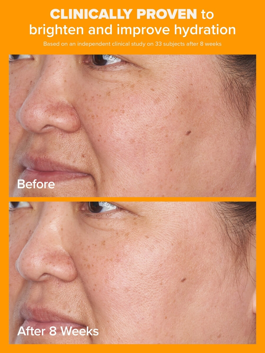hydratační krém s 5 vitamínem c a spf 50