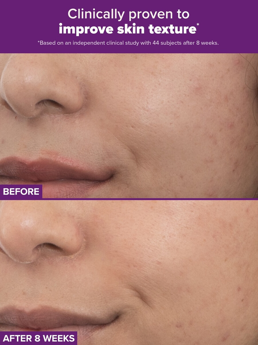 clinical pro duální retinoidní léčba s retinaldehydem