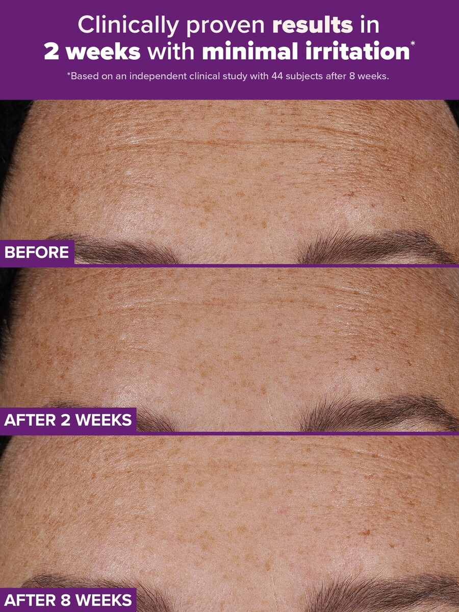 clinical pro duální retinoidní léčba s retinaldehydem