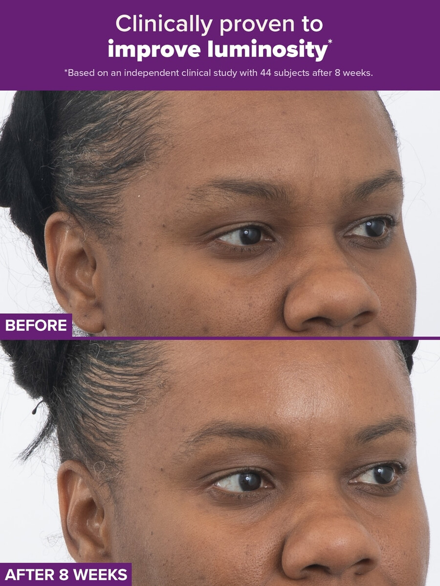 clinical pro duální retinoidní léčba s retinaldehydem